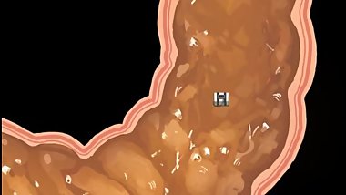 size matters Enteric exploration